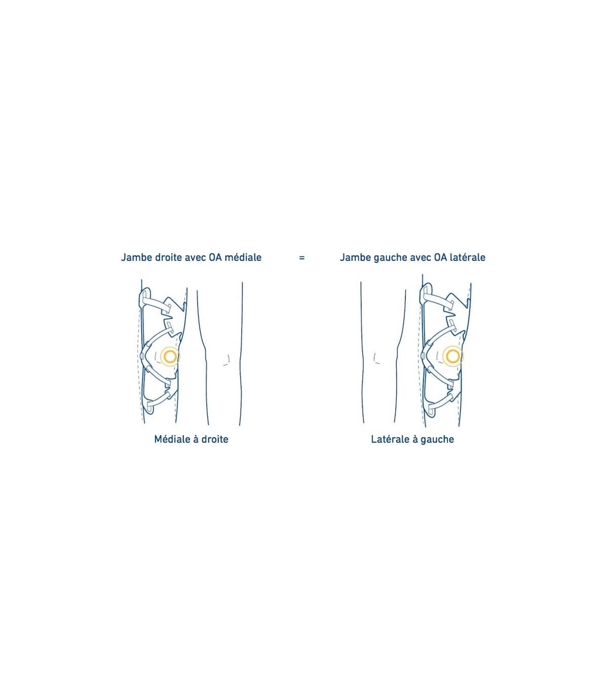 GenuTrain® OA - Soulagement et stabilisation ciblés de l'arthrose